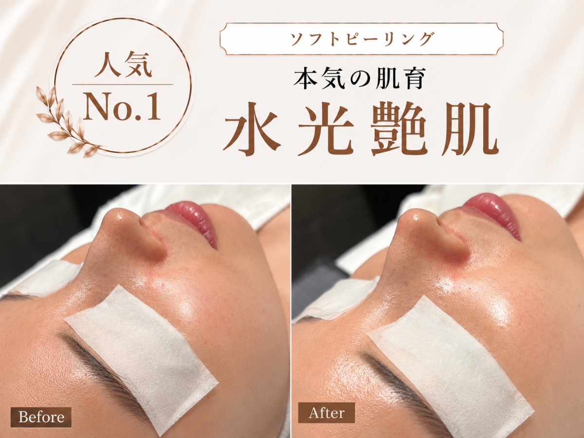ソフトピーリングの施術イメージ