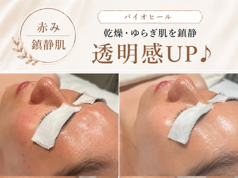 バイオヒールの施術イメージ
