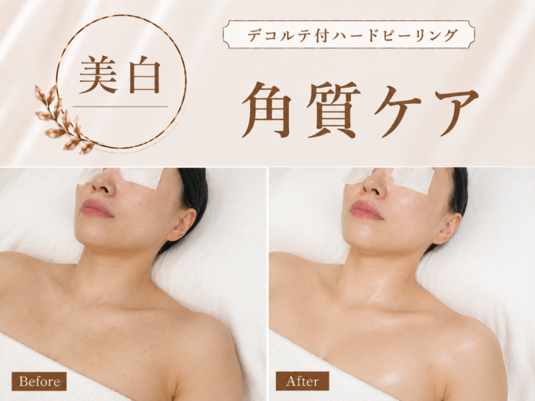 デコルテ付ハードピーリングの施術イメージ
