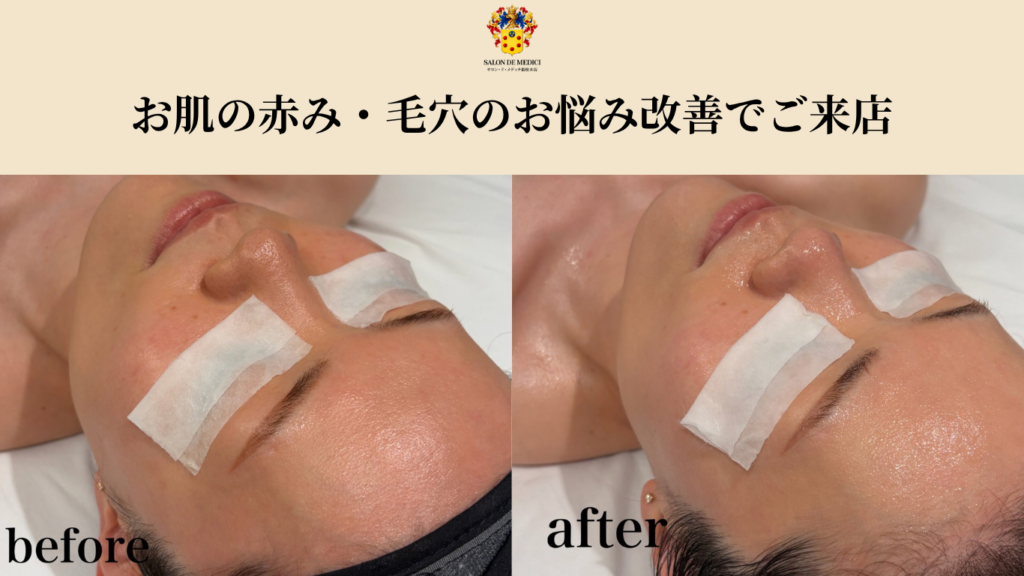 初回のお客様：m様 ビフォーアフター画像